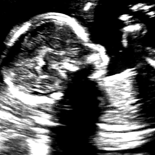 His twenty-week scan: his head in profile with one hand up beside it